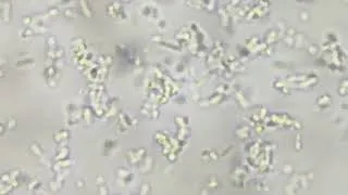 Thumbnail: Unstained Bacteria under the Microscope