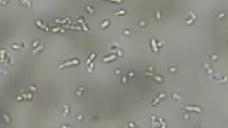Thumbnail: Motile  Enterococcus under the microscope 