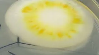 Thumbnail: Penicillium growth on SDA