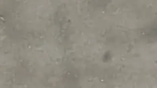 Thumbnail: Motility bacteria under the microscope-Pseudomonas aeruginosa 