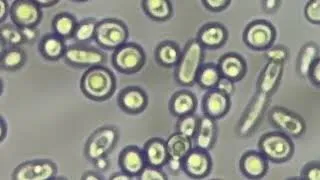Thumbnail: Ghosts in the Lens: The Pale World of Unstained Yeast