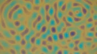 Thumbnail: 1 Hour Hypnotic Wave Interference Simulation | Teal & Gold Ripple Patterns 4K | Screensaver 4K