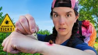 Thumbnail: Hacks for Dealing With Ticks on Trail I Actually Use!