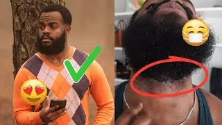 Thumbnail: 4 Tips I Used To Reduce Ingrown Hairs and Razor Bumps After A Haircut | How To Maximize Beard Tricks