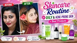 Thumbnail: Skincare Routine for Oily & Acne-Prone Skin + Best Products"🌸||Acne-Free Skin Guide✨||Home Remedies🌿