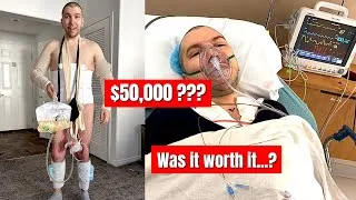 Thumbnail: I Paid HOW MUCH for My Plastic Surgery?? (Tummy Tuck, Lipo, Body Lift, Arm & Thigh Lift)