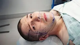Thumbnail: They Cut Open My Face… Here’s What Happened