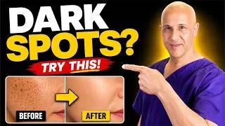 Thumbnail: THE #1 WAY TO HELP FADE DARK SPOTS | Dr. Mandell