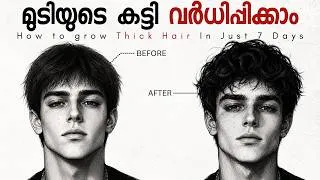 Thumbnail: How To Grow Thick Hair( 4 Science - Based Secrets)