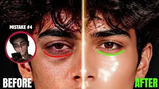 Thumbnail: Why Your Eyes Look Unattractive😳| 7 Mistakes That Are Ruining Them