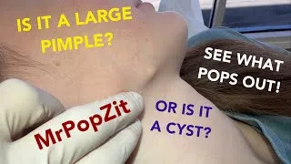 Thumbnail: Can you see the face on what pops out!? Amazing pop! Just in time for school pics! Puppy face pop!