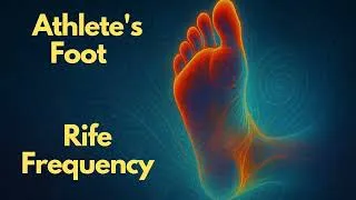 Thumbnail: Athlete’s Foot Rife Frequency | Anti-fungal Healing Tones