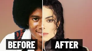 Thumbnail: How Many Surgeries Did Michael Jackson Really Have?