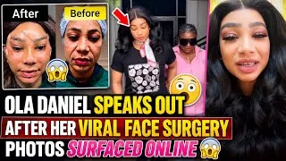 Thumbnail: OMO😱 OLA DANIEL SPEAKS OUT AFTER HER VIRAL FACE SURGERY PHOTOS SURFACED ONLINE 😱
