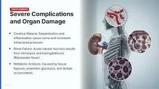 Thumbnail: PATHOPHYSIOLOGY OF MALARIA