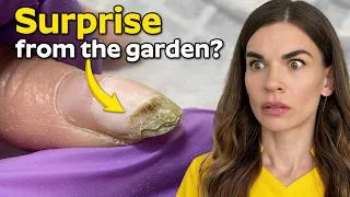 Thumbnail: The Hardest Working Hands I've Seen