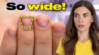 Thumbnail: I Tested 2 Shapes on Wide Nails