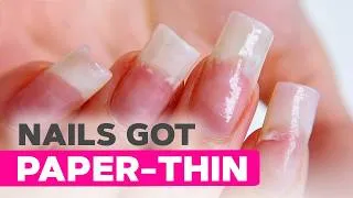 Thumbnail: Brittle Nails Treatment | Dual Forms with Builder Gel | Chic French Tips