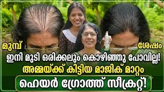 Thumbnail: അയ്യോ അമ്മക്ക് കിട്ടിയ മാറ്റം ശെരിക്കും shocking തന്നെയാണ്😱 ഇനി മുടി ഒരിക്കലും കൊഴിയില്ല😱🔥🔥