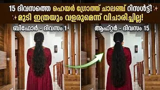 Thumbnail: അയ്യോ😱 വിശ്വസിക്കാൻ കഴിയുന്നില്ല വെറും 15ദിവസം കൊണ്ട് വന്ന മാറ്റം🔥15days hair  challenge റിസൾട്ട്‌