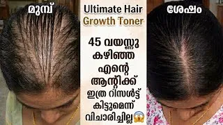 Thumbnail: 45വയസ്സ് കഴിഞ്ഞ ആന്റിയുട മുടിയിലെ ഈ ഒരു മാറ്റം അയ്യോ... ശെരിക്കും ഞെട്ടിപോകും😱#haircare 