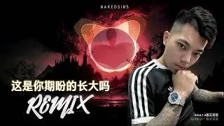Thumbnail: 张齐山 ZQS - 这是你期盼的长大吗【DJ Remix 舞曲｜歌词 Lyrics】抖音神曲🔥