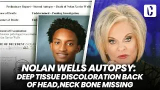 Thumbnail: NOLAN WELLS AUTOPSY: DEEP TISSUE DISCOLORATION BACK OF HEAD, NECK BONE MISSING