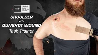 Thumbnail: Treating Complex Gunshot Wounds with SMRT Shoulder with Gunshot Wound