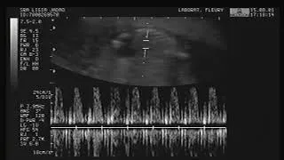 Thumbnail: VHS Video Effects & Audio Effects: Oldschool Ultrasound 🎞