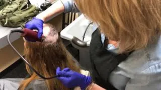 Thumbnail: AMAZING transformation!  Woman with thin to little hair on top gets hair system.