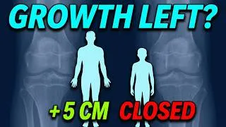 Thumbnail: You Still Have Growth Left Late Bloomers (Here's How To Know)