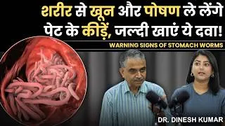 Thumbnail: Eat This Medicines to Kill Stomach Worms | Signs of Intestinal Worms Don't Ignore | Dr. Dinesh Kumar