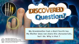Thumbnail: My grandmother had a Short Fourth Toe. Why is that ...? AR-VR