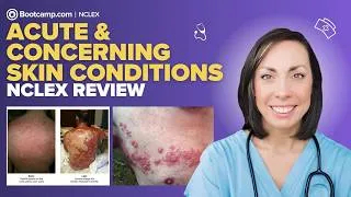 Thumbnail: Acute & Concerning Skin Conditions | NCLEX® Review