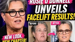 Thumbnail: Rosie O'Donnell STUNS Fans With Facelift Results.