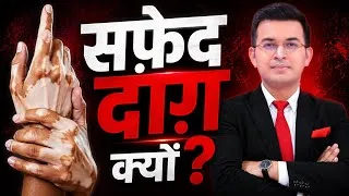 Thumbnail: Vitiligo Explained: Why White Patches Appear on Skin !  Healthbook | Shubhankar Mishra |