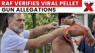 Thumbnail: Delhi Protest Row: RAF Launches Probe Into Pellet Gun Allegations During NEET Protest