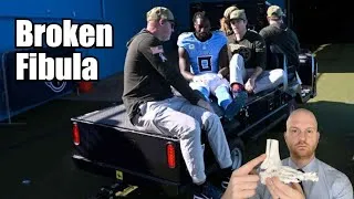 Thumbnail: Calvin Ridley Injury Explained!  Calvin Ridley Fibula Fracture