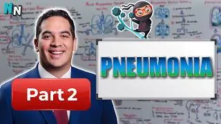 Thumbnail: Pneumonia: Part 2 | Clinical Medicine