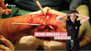 Thumbnail: NCLEX Review: Bone Breaks 101 | Types of Fractures + Complications