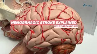 Thumbnail: Hemorrhagic Stroke NCLEX Breakdown | Symptoms, Risk Factors, Complications
