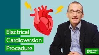 Thumbnail: Electrical Cardioversion | Surgeon Explains