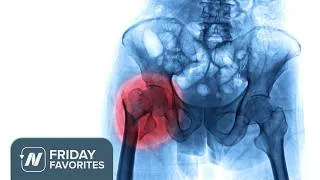 Thumbnail: Friday Favorites: Acid Reflux Medicine May Cause Osteoporosis