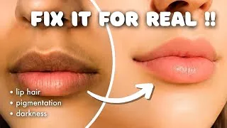 Thumbnail: How to Get Rid of DARKNESS Around the Mouth 💋 | Upper Lip Hair REMOVAL METHODS 🌸 #skincare 