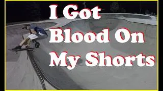 Thumbnail: I Got Blood On My Shorts