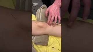 Thumbnail: How to Treat Knee Pain with Dry Needling | IAOMM Course UK