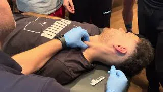 Thumbnail: Dry Needling the SCM (Sternocleidomastoid) | Technique, Safety & What Most Clinicians Miss