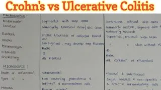 Thumbnail: Crohn's Disease vs Ulcerative Colitis | GIT Pathology