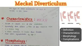 Thumbnail: Meckel Diverticulum | GIT Pathology