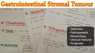 Thumbnail: GIST | Gastrointestinal Stromal Tumour | GIT Pathology
